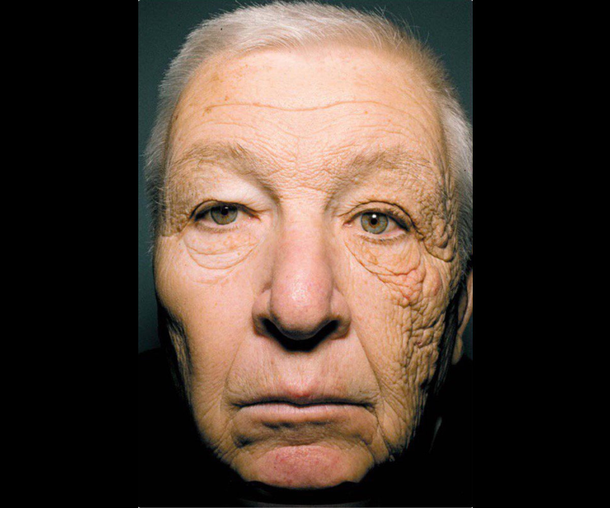 The Toll of Sun Damage and Importance of Quality Skin Care