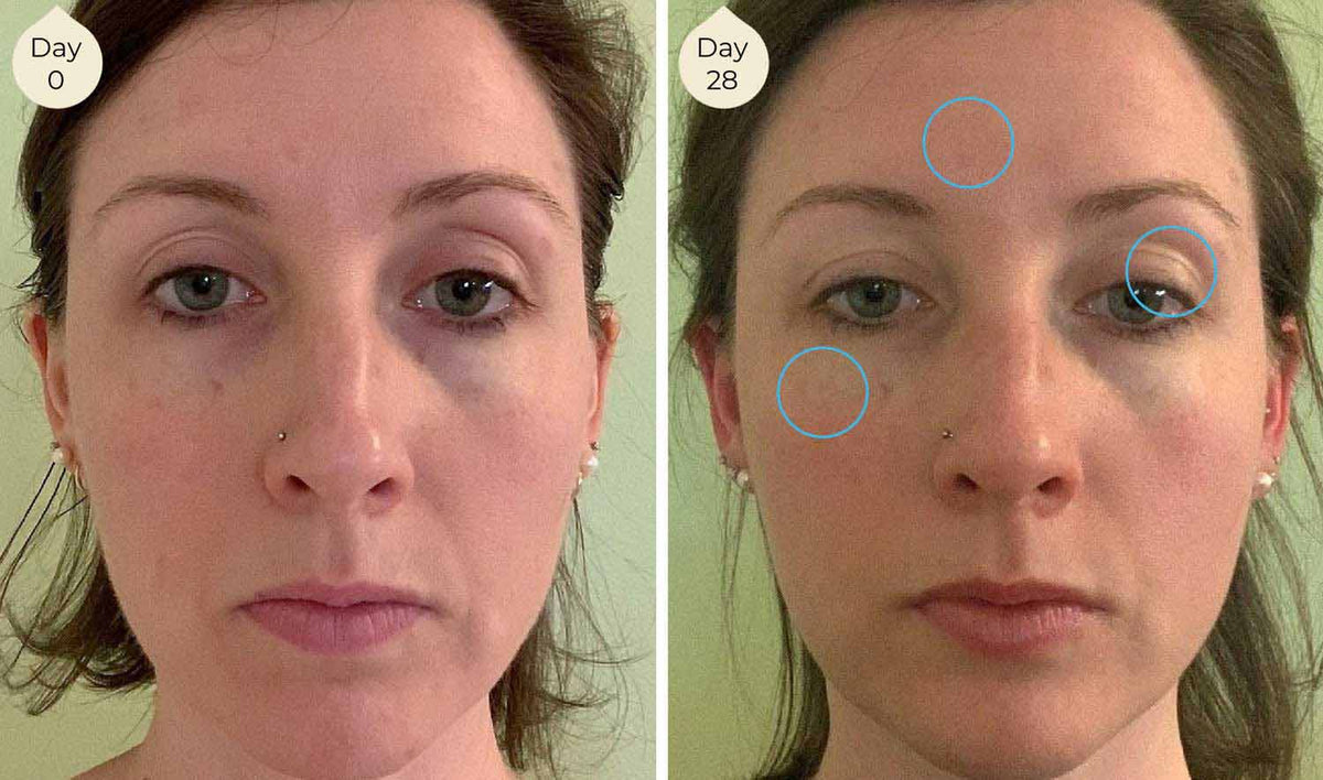 LightWater Skin Nutrition facial skincare before and after showing more even skin tone, reduced hooded eye, youthful skin glow, reduced spots